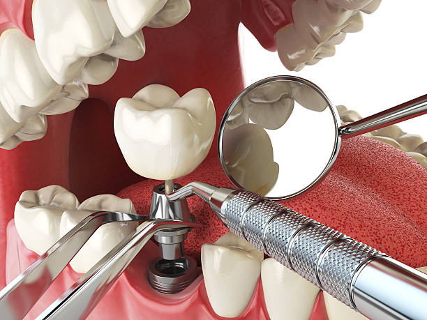 Best Root Canal Emergency Dentist  in Lockport, IL